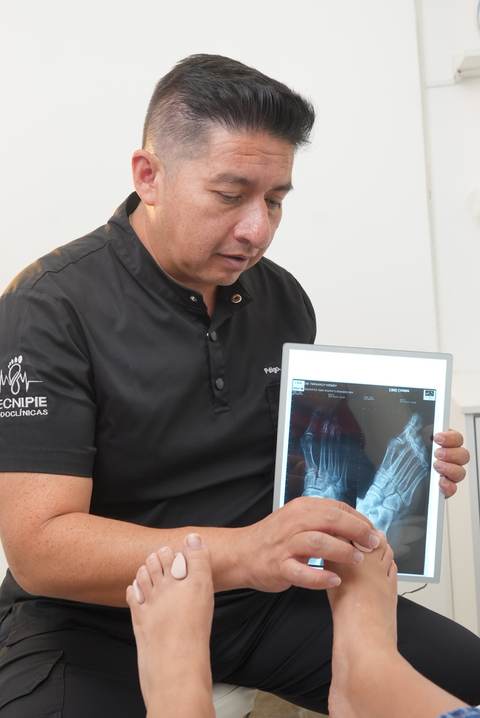 Podólogo revisando una radiografía del pie en una tablet durante la valoración